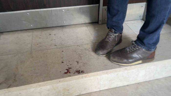 İstanbul’da Üniversite Öğrencisi Genç Kıza Bıçaklı Saldırı: “Abi Korkuttun Beni” Dediği Şahıs Belinden Bıçakladı