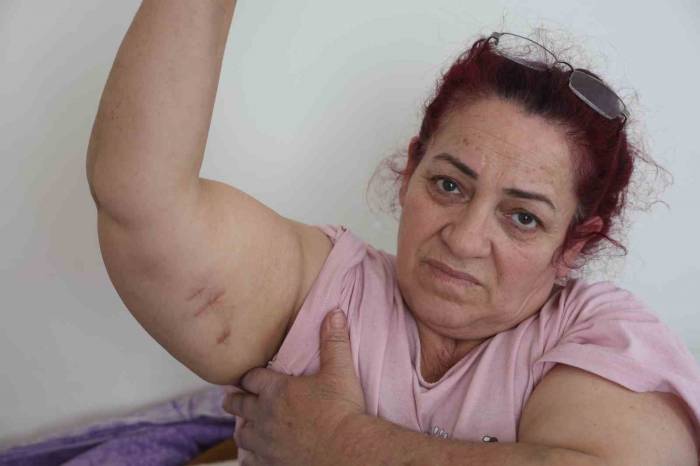 Köpeklerin Saldırısına Uğrayan Kadın: “Ben O An Öldüğümü Sandım”