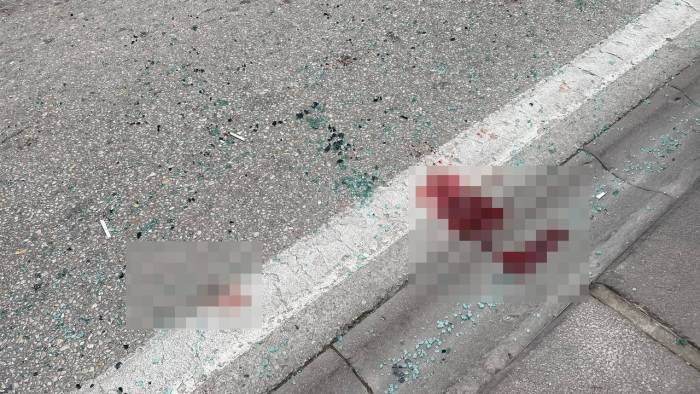 Dalgınlığı Az Daha Hayatına Mal Oluyordu