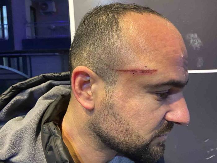 İşe Gitmek İçin Otomobiline Bindi, Dehşeti Yaşadı