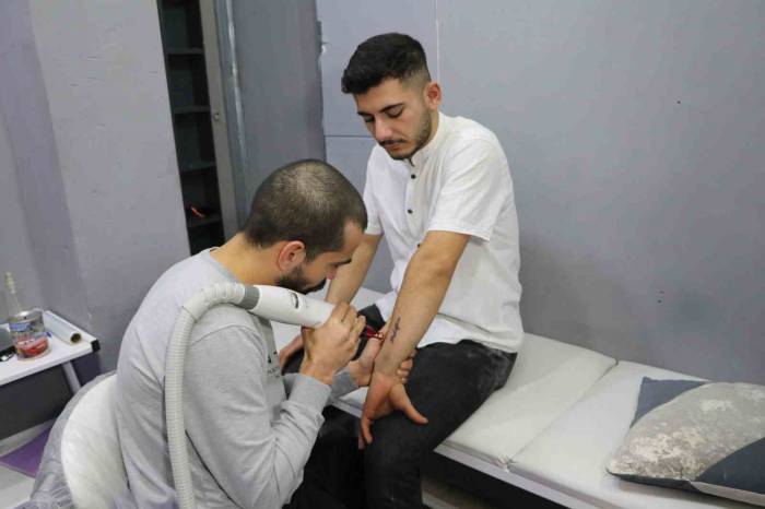 Ayrılan Sevgililerin Dövme Sildirme Telaşı