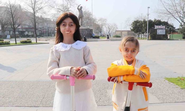 Erken Yaşlanma Hastası Kız Kardeşler Yaşama Sıkı Sıkı Tutunuyor