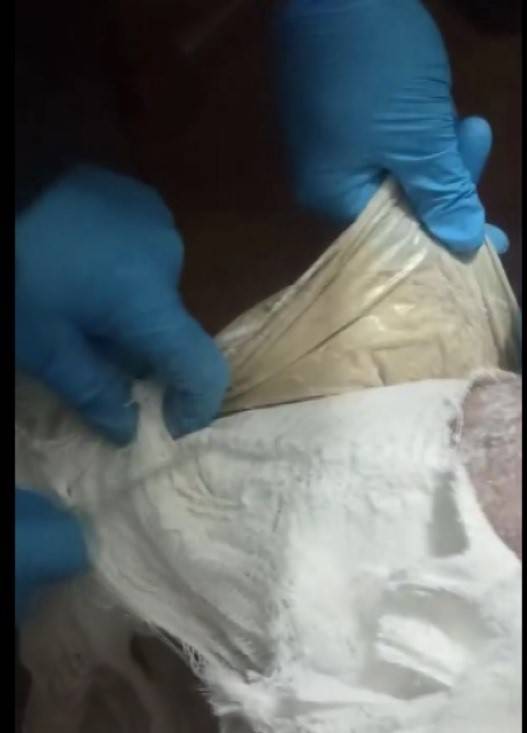 Yolcunun Ayağına Sarılı Alçından Eroin Çıktı