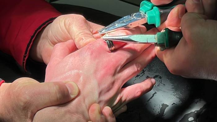 Parmağına Yüzük Sıkışan Vatandaşı İtfaiye Kurtardı