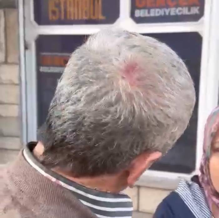 Maltepe’de Broşür Dağıtan Ak Partili’yi Darp Etmişlerdi, 6 Kişi Gözaltına Alındı