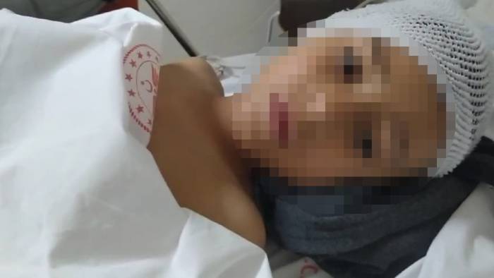 Okula Yaptırılan Hayrat Çeşmenin Mermer Bloğu Çöktü, 7 Yaşındaki Eymen’in Kaval Kemiği Kırıldı