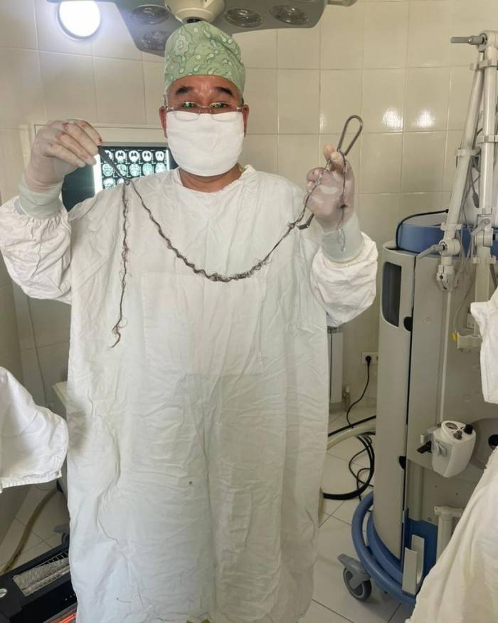 Kırgızistanlı Çocuğun Beyninden Saç Çıktı