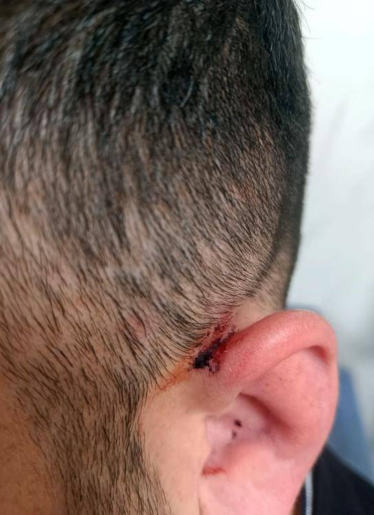 Diyarbakır Ve Şırnak’ta Kaçak Elektrik Kullanımına Hapis Cezası