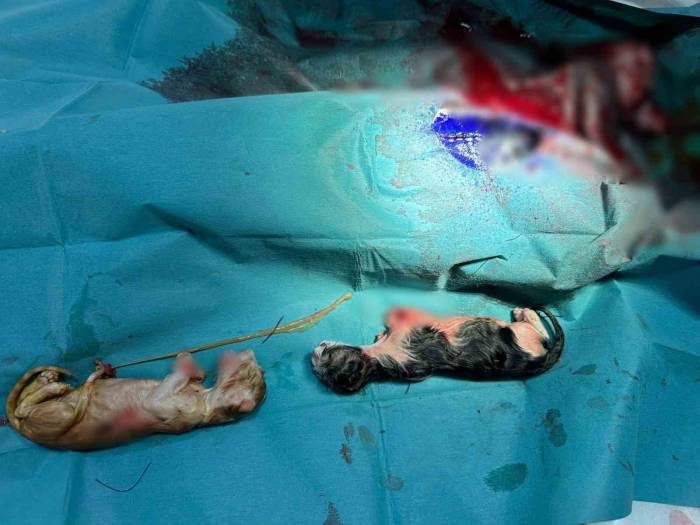 Normalinden 2 Kat Büyük 3 Kedi Yavrusu Sezaryen İle Alındı