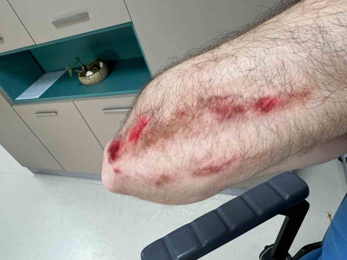 Üsküdar’da Site Sakinleri İle Yöneticileri Arasında Kavga Kamerada