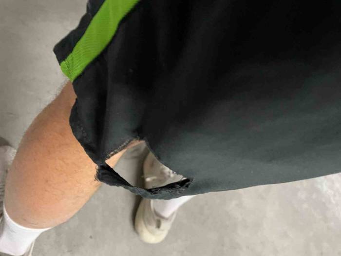 Kağıthane’de Yarışmaya Hazırlanan Sporcuyu Başıboş Köpek Isırdı