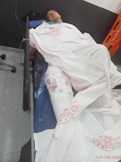 Anneler Günü İçin Çiçek Siparişi Götürürken Kaza Yapan Kuryenin Yürüme İhtimali Düşük