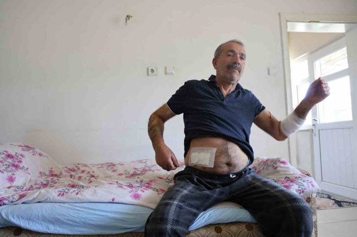 Köpeklerin Saldırdığı Adam Dehşeti Yaşadı