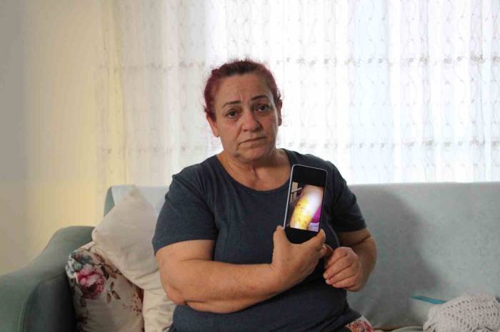 Köpek Saldırısında Yaşadığı Dehşet Anlarını Unutamayan Kadın Tek Başına Sokağa Çıkamıyor