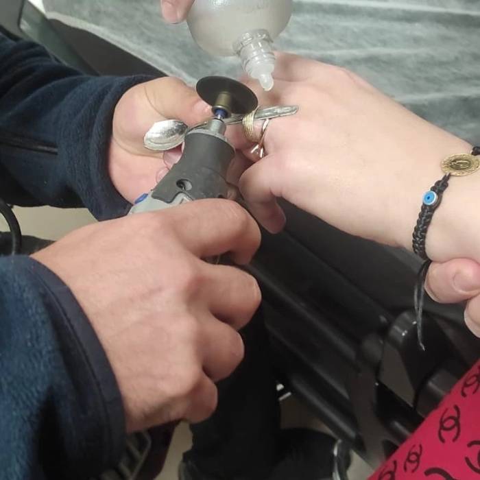 Parmağına Yüzük Sıkıştı, Soluğu Hastanede Aldı