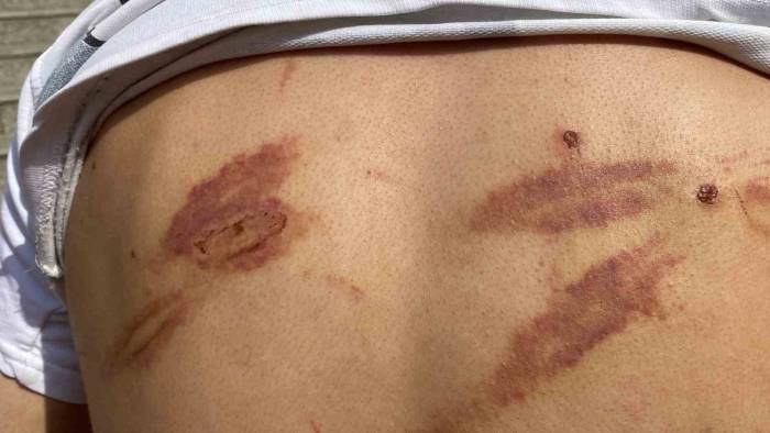 Öldüresiye Darp Edilmişti, Yaşadıklarını Anlattı