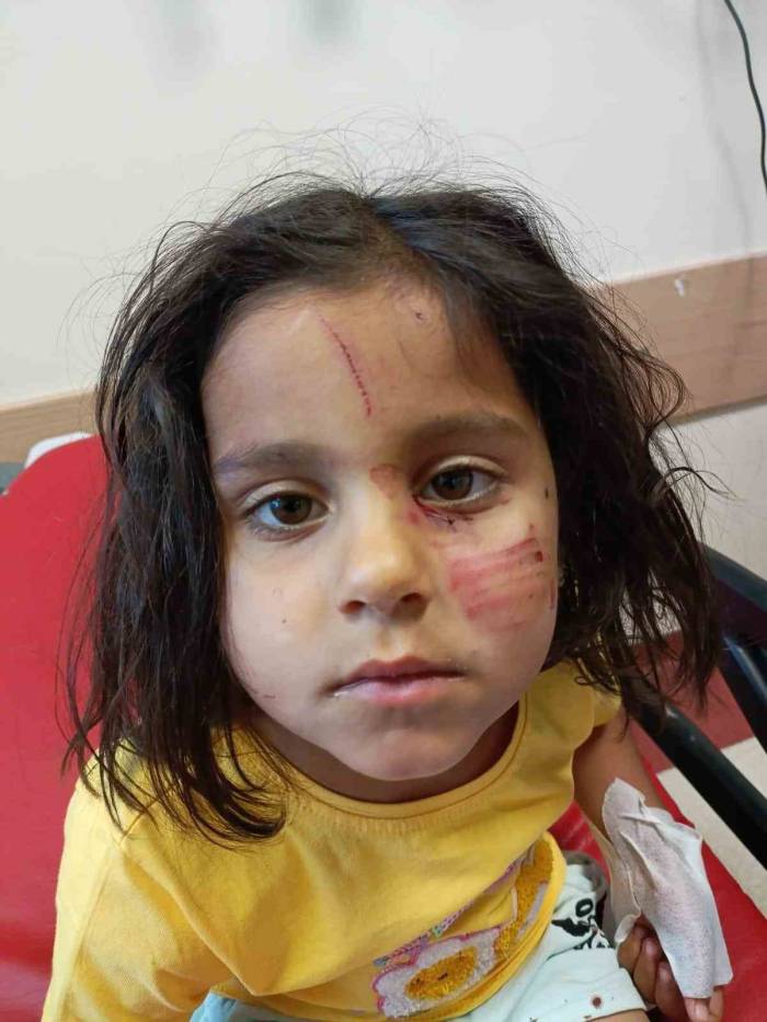 Başıboş Köpeklerin Saldırısına Uğrayan Çocuk Yaralandı