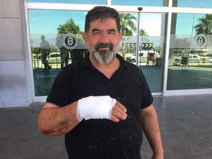 Acemi Kasaplar Hastanelik Oldu