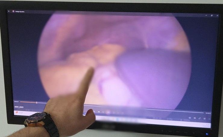 tum-organlari-ters-yerde-doktorlar-bile-sasirdi.jpg