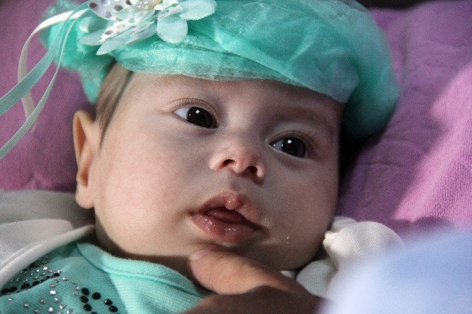 Dört Aylık Bebek ’Doku Yapıştırıcısıyla’ Hayata Tutundu