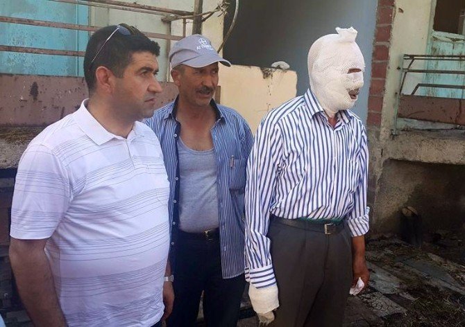 Çorum’da Yangın: 1 Yaralı
