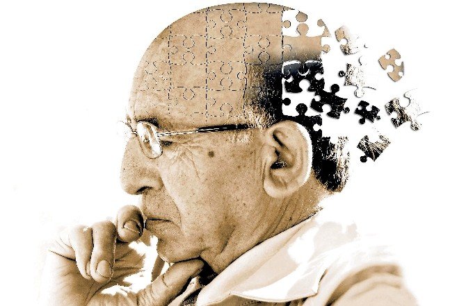 Alzheimer’a Karşı Aktif Beyin