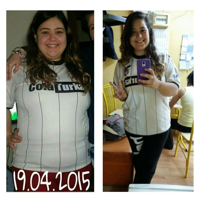 Obeziteden Kurtulup, Hayallerine Kavuştular