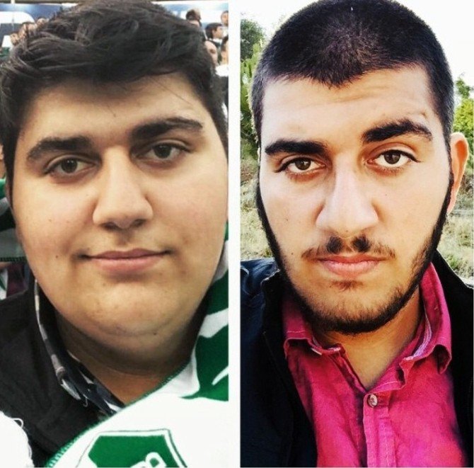 153 Kilodan 90 Kiloya Düştü