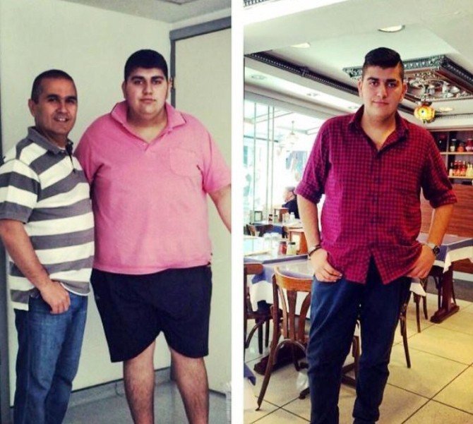 153 Kilodan 90 Kiloya Düştü