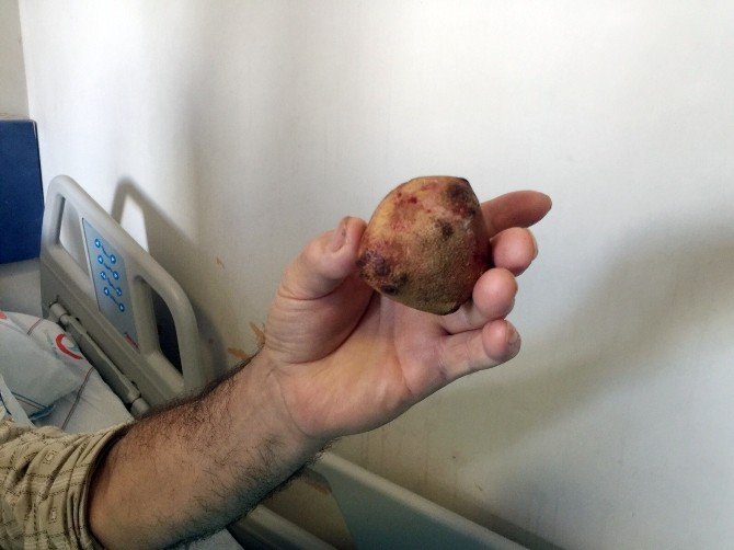 Çaycuma Devlet Hastanesi’nde Başarılı Ameliyatla Sağlığına Kavuştu