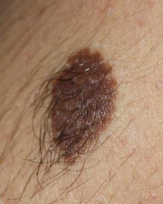 “‘Ben’, Deyip Geçmeyin!”