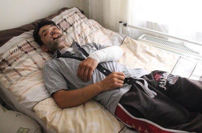 Yüzünde Tüfek Fişeği Patlayan Ahmet İlk Ameliyatını Oldu