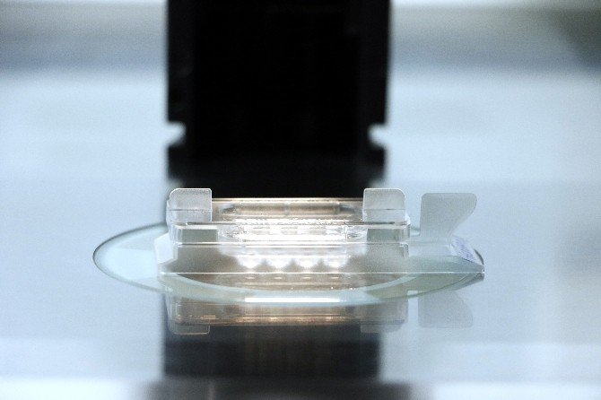 Çocuk Sahibi Olamayan Genç Çiftlere Tüp Bebek Uyarısı