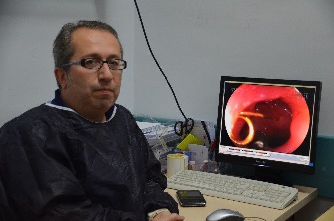 Çocukların Yuttukları Cisimler Görenleri Şaşırtıyor