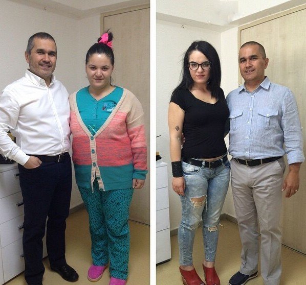 Genç Kız, 105 Kilogramdan 60 Kilograma Düştü