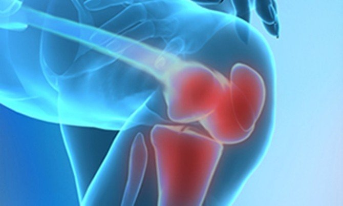 Protez Operasyonu Sonrası Fizik Tedavinin Önemi