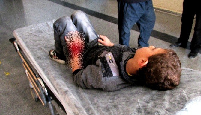 Gaziantep’te Otomobilin Çarptığı Suriyeli Çocuk Yaralandı