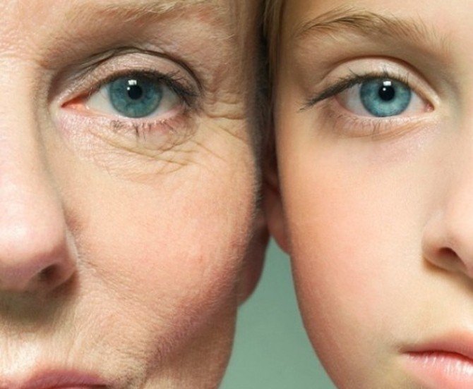 Gözleri Kısarak Bakmak Yaşlandırıyor