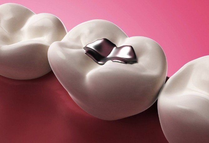 Dt. Özlü: "Cıvalı Dolguda Tehlike Büyük"