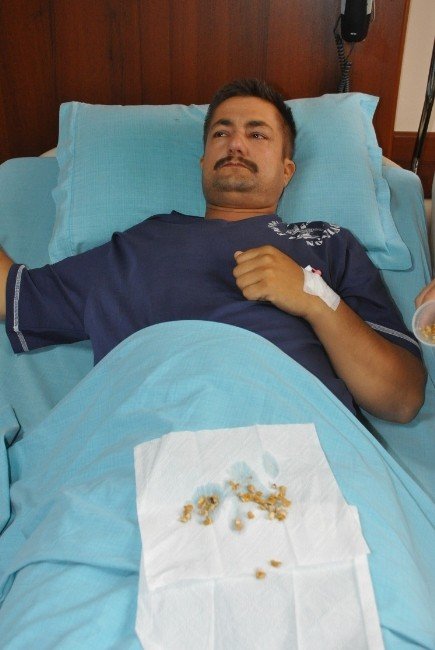 Iraklı Hastanın Böbreğinden 60 Taş Çıktı