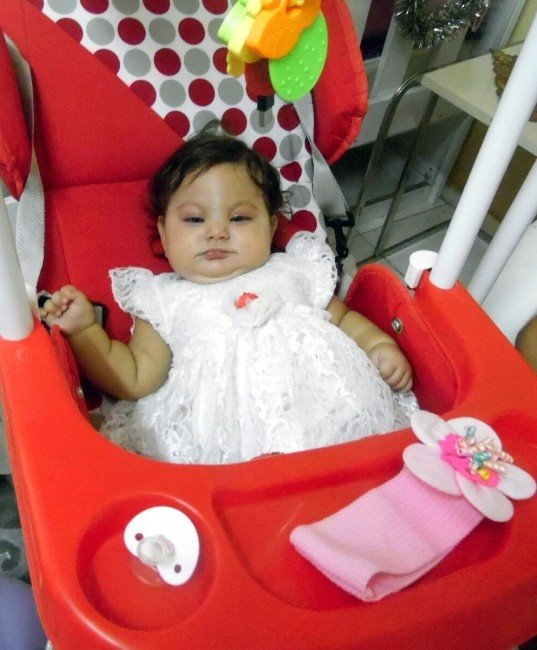 5 Aylık Mira Bebek 6 Saatlik Operasyonla Yaşama Tutundu