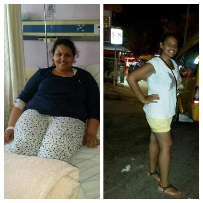 6 Ayda 57 Kilo Verdi, Abiye Hayaline Kavuştu...