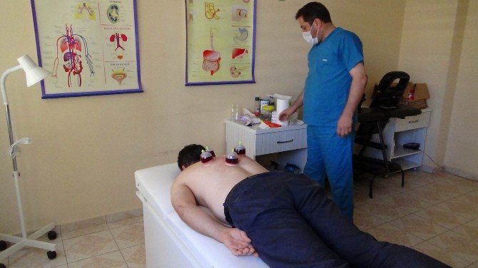 Saç Dökülmesine Hacamatlı Çözüm