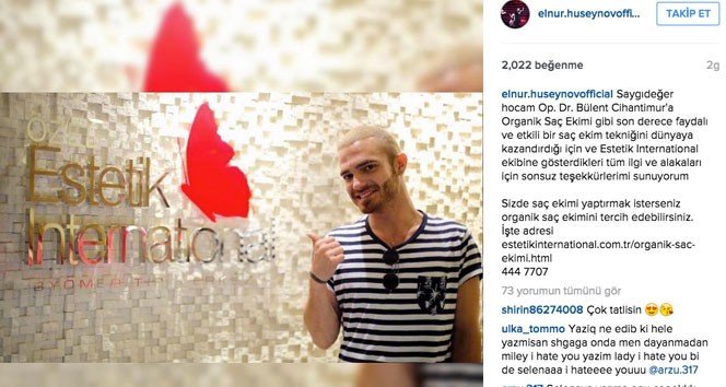 Elnur, Organik Saç Ekimi Sayesinde Beresini Çıkardı