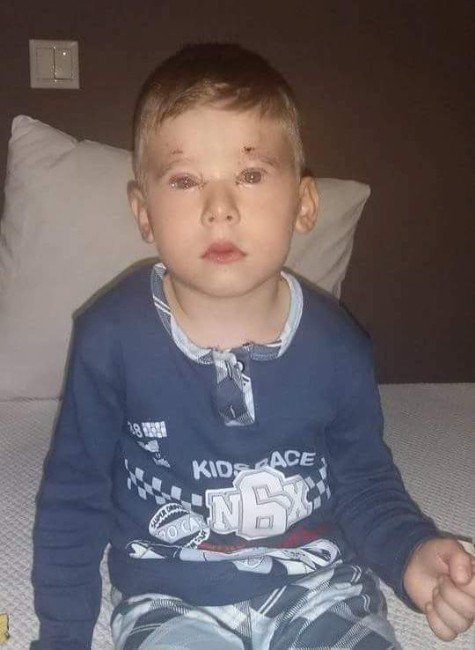 Minik Melih Işığı Gördü