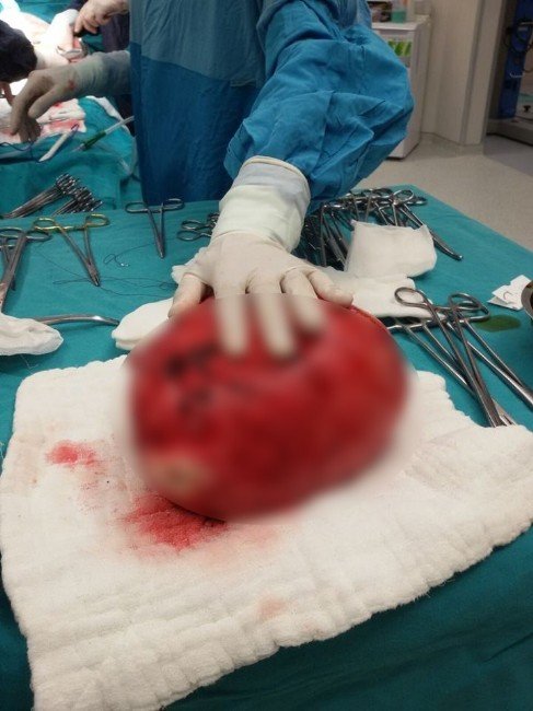 Rahminden 6.5 Kg’lık Ur Çıktı