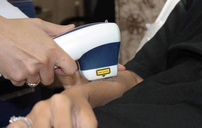 Hibrid Diode Teknolojisiyle İstenmeyen Kıllarınızdan Kurtulun