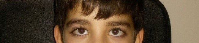 Op. Dr. Yakut: "Şaşılık Her Yaşta Görülebilir"