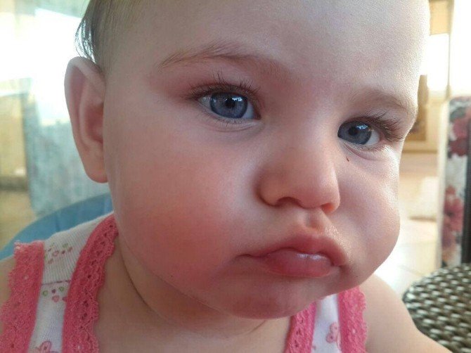 Bursalılar Ferah Bebek İçin Seferber Oldu