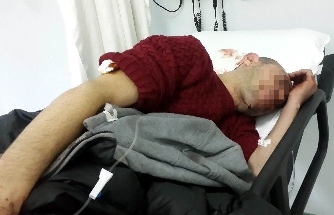 Evine Gittiği Travesti, Daha Önce Sahte Para Verdiği Kişi Çıkınca Vuruldu